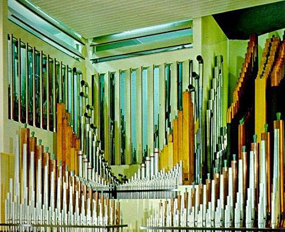 Organ in Previous Location 2